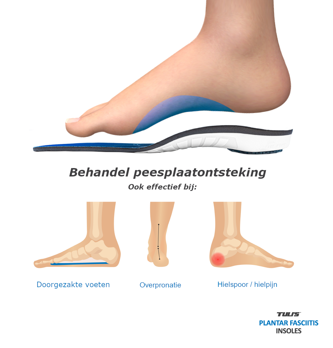 Tuli's Plantar Fascia Insoles