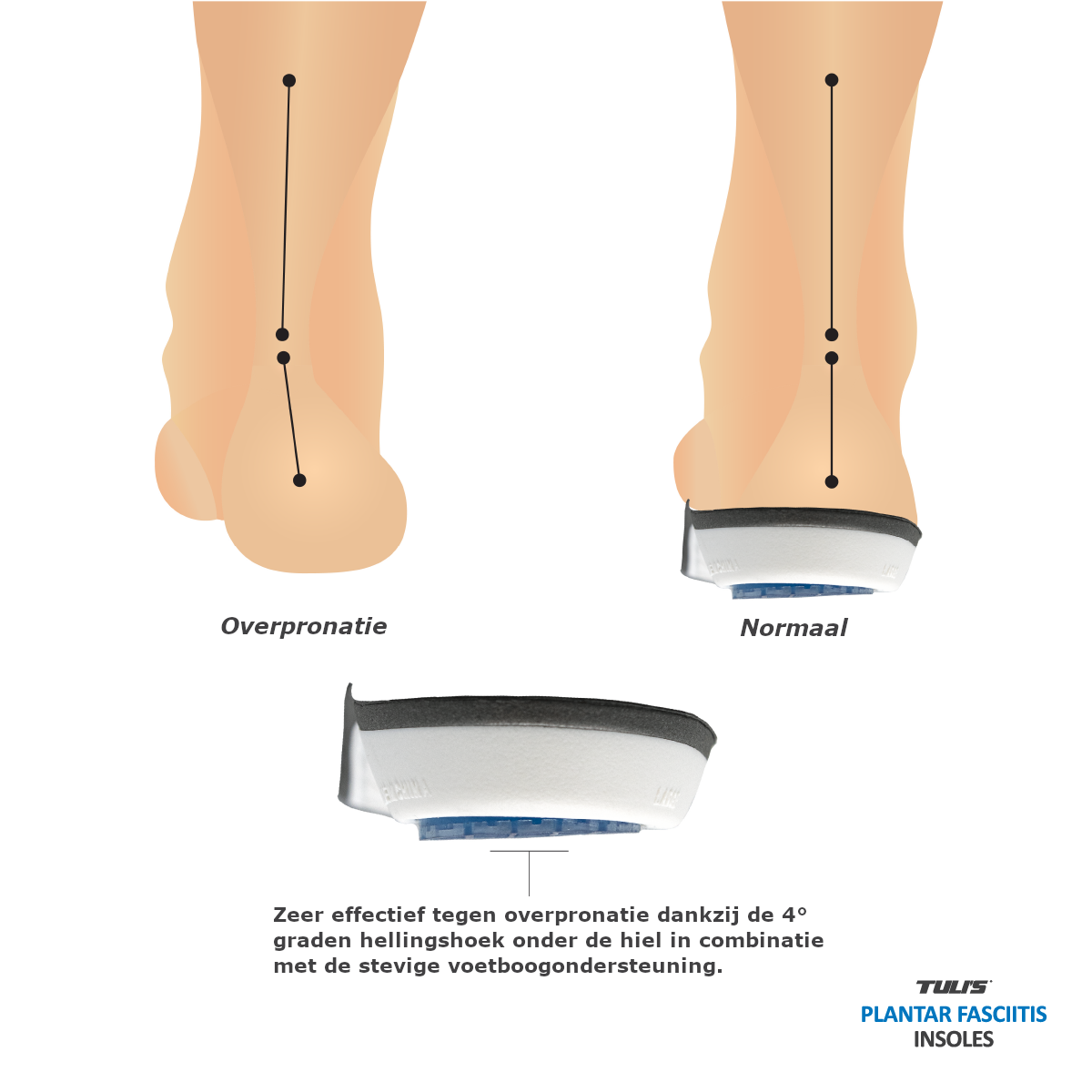 Tuli's Plantar Fascia Insoles
