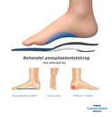 Tuli's Plantar Fascia Insoles
